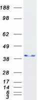 NPM1 / NPM / Nucleophosmin Protein - Purified recombinant protein NPM1 was analyzed by SDS-PAGE gel and Coomassie Blue Staining