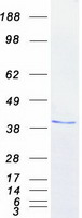 NPM1 / NPM / Nucleophosmin Protein - Purified recombinant protein NPM1 was analyzed by SDS-PAGE gel and Coomassie Blue Staining