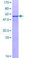 NPM2 Protein - 12.5% SDS-PAGE of human NPM2 stained with Coomassie Blue