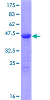 NPM3 Protein - 12.5% SDS-PAGE of human NPM3 stained with Coomassie Blue