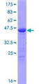 NPM3 Protein - 12.5% SDS-PAGE of human NPM3 stained with Coomassie Blue