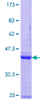NPM3 Protein - 12.5% SDS-PAGE Stained with Coomassie Blue.
