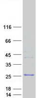 NPM3 Protein - Purified recombinant protein NPM3 was analyzed by SDS-PAGE gel and Coomassie Blue Staining