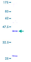 NPPB / BNP Protein - 12.5% SDS-PAGE of human NPPB stained with Coomassie Blue