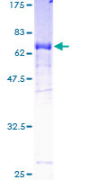 NPR2L / TUSC4 Protein - 12.5% SDS-PAGE of human TUSC4 stained with Coomassie Blue