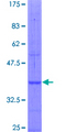 NPR3 Protein - 12.5% SDS-PAGE Stained with Coomassie Blue.