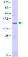 NPRA / NPR1 Protein - 12.5% SDS-PAGE Stained with Coomassie Blue.