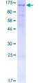 NPRB / NPR2 Protein - 12.5% SDS-PAGE of human NPR2 stained with Coomassie Blue