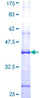 NPRL3 Protein - 12.5% SDS-PAGE Stained with Coomassie Blue