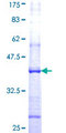 NPRL3 Protein - 12.5% SDS-PAGE Stained with Coomassie Blue