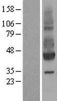 NPTN / SDR1 Protein - Western validation with an anti-DDK antibody * L: Control HEK293 lysate R: Over-expression lysate