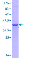 NPTX1 Protein - 12.5% SDS-PAGE Stained with Coomassie Blue.