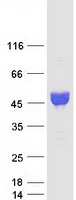 NPTX1 Protein - Purified recombinant protein NPTX1 was analyzed by SDS-PAGE gel and Coomassie Blue Staining