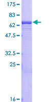 NPTX2 Protein - 12.5% SDS-PAGE of human NPTX2 stained with Coomassie Blue