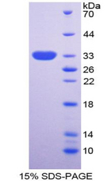 NPTX2 Protein - Recombinant Neuronal Pentraxin II By SDS-PAGE