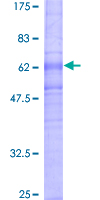 NPY1R Protein - 12.5% SDS-PAGE of human NPY1R stained with Coomassie Blue