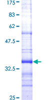 NPY1R Protein - 12.5% SDS-PAGE Stained with Coomassie Blue.