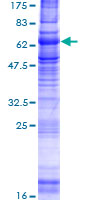 NPY2R Protein - 12.5% SDS-PAGE of human NPY2R stained with Coomassie Blue