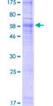 NPY4R / PPYR1 Protein - 12.5% SDS-PAGE of human PPYR1 stained with Coomassie Blue
