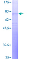 NPY5R Protein - 12.5% SDS-PAGE of human NPY5R stained with Coomassie Blue