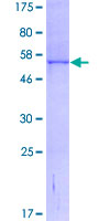 NQO1 Protein - 12.5% SDS-PAGE of human NQO1 stained with Coomassie Blue