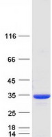NQO1 Protein - Purified recombinant protein NQO1 was analyzed by SDS-PAGE gel and Coomassie Blue Staining