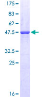NQO2 Protein - 12.5% SDS-PAGE of human NQO2 stained with Coomassie Blue