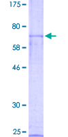 NR0B1 / DAX1 Protein - 12.5% SDS-PAGE of human NR0B1 stained with Coomassie Blue