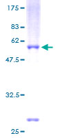 NR0B2 Protein - 12.5% SDS-PAGE of human NR0B2 stained with Coomassie Blue