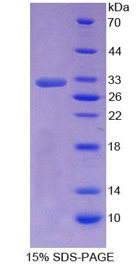 NR0B2 Protein - Recombinant  Small Heterodimer Partner By SDS-PAGE