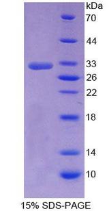 NR0B2 Protein - Recombinant  Small Heterodimer Partner By SDS-PAGE