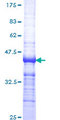 NR1A2 / THRB Protein - 12.5% SDS-PAGE Stained with Coomassie Blue.