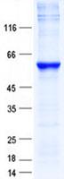 NR1A2 / THRB Protein
