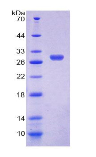 NR1A2 / THRB Protein - Recombinant Thyroid Hormone Receptor Beta By SDS-PAGE