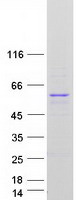 NR1A2 / THRB Protein - Purified recombinant protein THRB was analyzed by SDS-PAGE gel and Coomassie Blue Staining