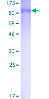 NR1D2 Protein - 12.5% SDS-PAGE of human NR1D2 stained with Coomassie Blue