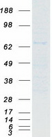 NR1D2 Protein - Purified recombinant protein NR1D2 was analyzed by SDS-PAGE gel and Coomassie Blue Staining