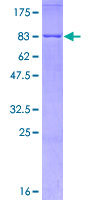 NR1H2 / LXR Beta Protein - 12.5% SDS-PAGE of human NR1H2 stained with Coomassie Blue