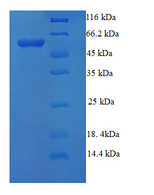 NR1H3 / LXR Alpha Protein