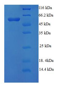 NR1H3 / LXR Alpha Protein