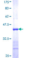 NR1H4 / FXR Protein - 12.5% SDS-PAGE Stained with Coomassie Blue.