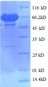 NR1H4 / FXR Protein