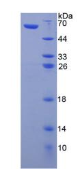 NR1H4 / FXR Protein - Recombinant  Farnesoid X Receptor By SDS-PAGE
