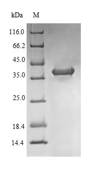 NR1I2 / PXR Protein - (Tris-Glycine gel) Discontinuous SDS-PAGE (reduced) with 5% enrichment gel and 15% separation gel.