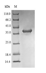NR1I2 / PXR Protein - (Tris-Glycine gel) Discontinuous SDS-PAGE (reduced) with 5% enrichment gel and 15% separation gel.