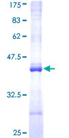 NR1I2 / PXR Protein - 12.5% SDS-PAGE Stained with Coomassie Blue.