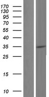 NR1I3 / CAR Protein - Western validation with an anti-DDK antibody * L: Control HEK293 lysate R: Over-expression lysate