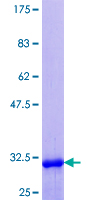 NR1I3 / CAR Protein - 12.5% SDS-PAGE Stained with Coomassie Blue.