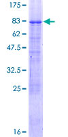 NR2C1 Protein - 12.5% SDS-PAGE of human NR2C1 stained with Coomassie Blue