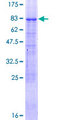 NR2C1 Protein - 12.5% SDS-PAGE of human NR2C1 stained with Coomassie Blue